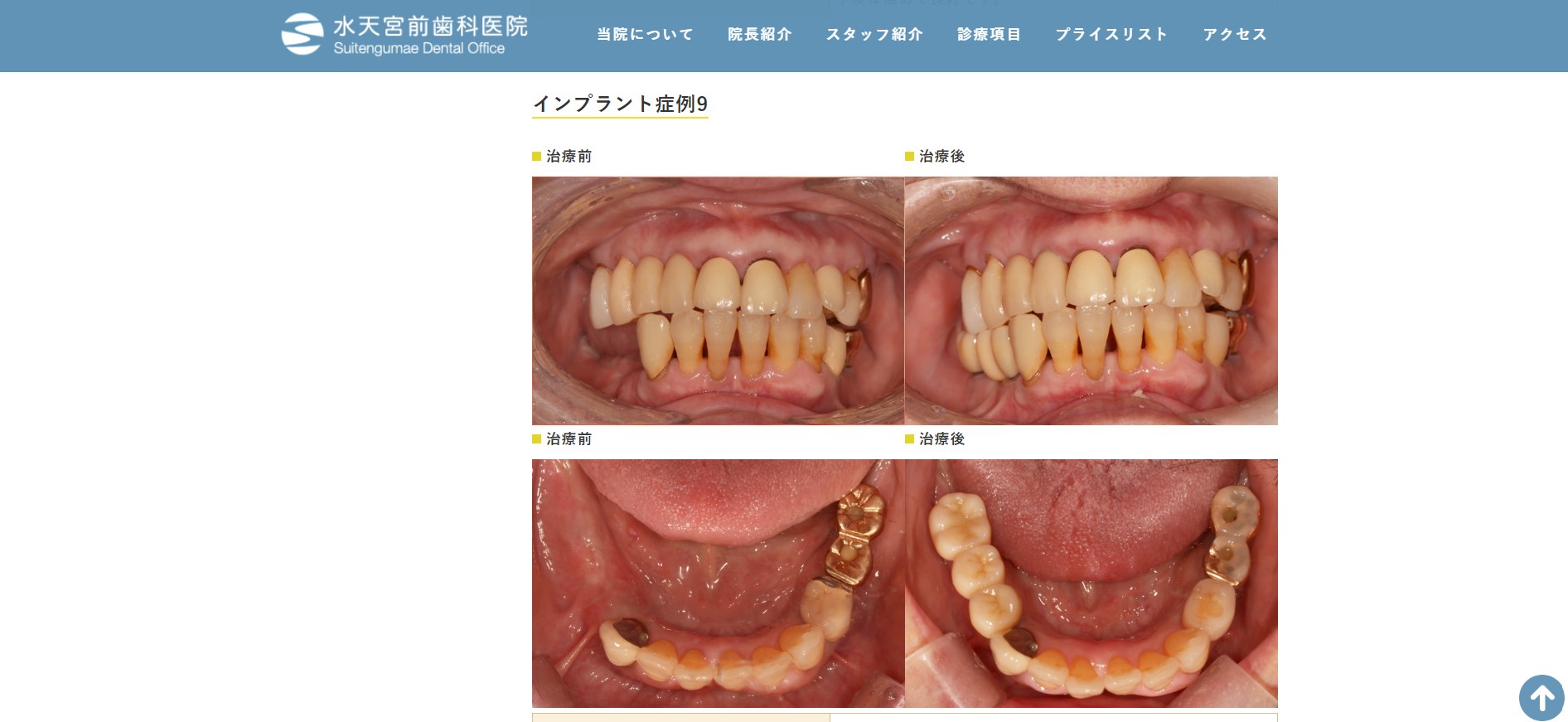 水天宮前歯科医院の症例